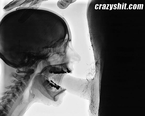 Skeletal Blow Job
